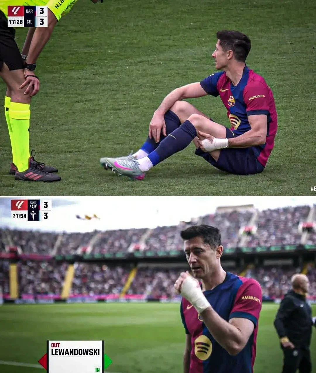 包含里昂完胜曼城,莱万三分雨点燃全场的词条 包含里昂完胜曼城,莱万三分雨点燃全场的词条